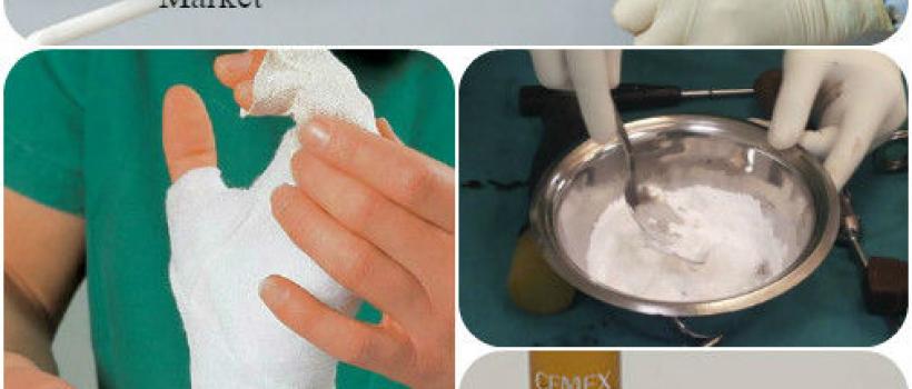 Orthopedic Bone Cement