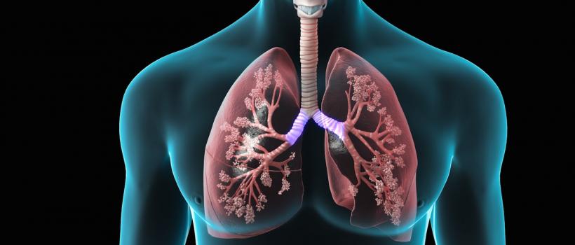 Chronic Obstructive Pulmonary Disease (COPD) Treatment
