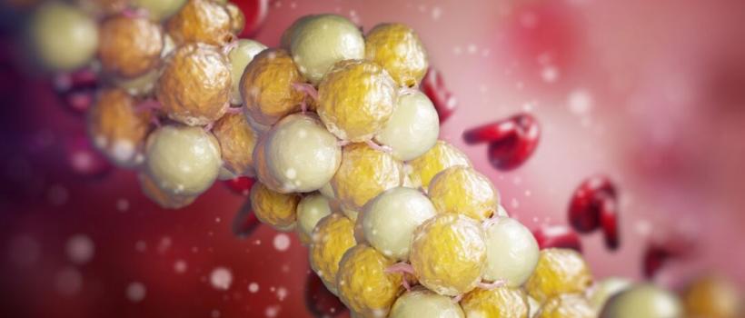 Dyslipidemia pipeline review