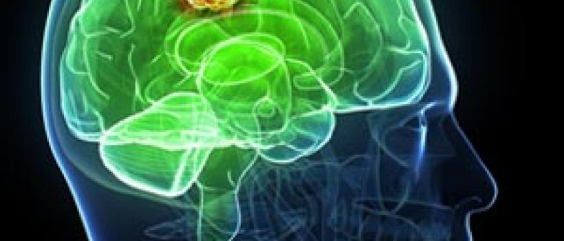 Glioblastoma Multiforme Treatment Market