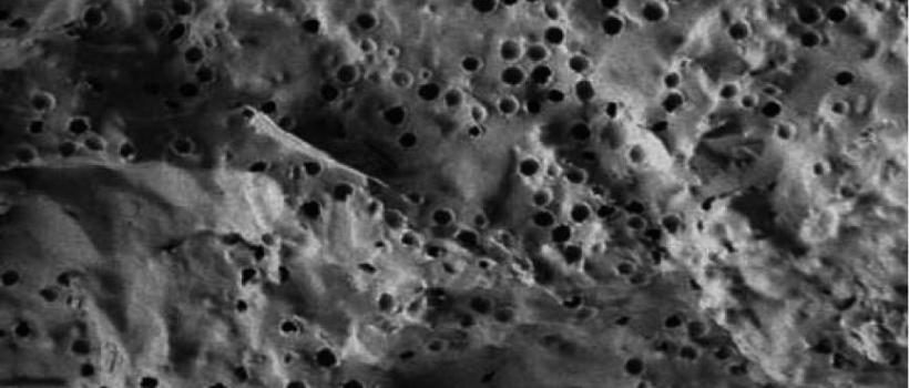 global Opaque Polymers market