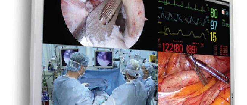 Global Surgical Imaging Market