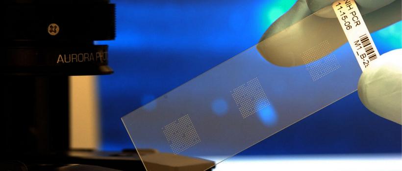 Global Biochips Market