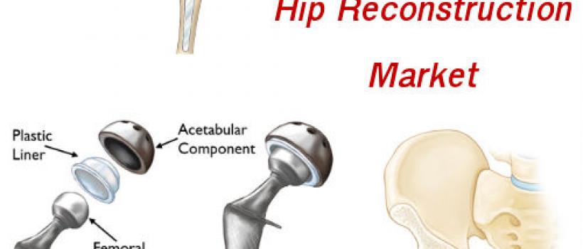 Hip Reconstruction