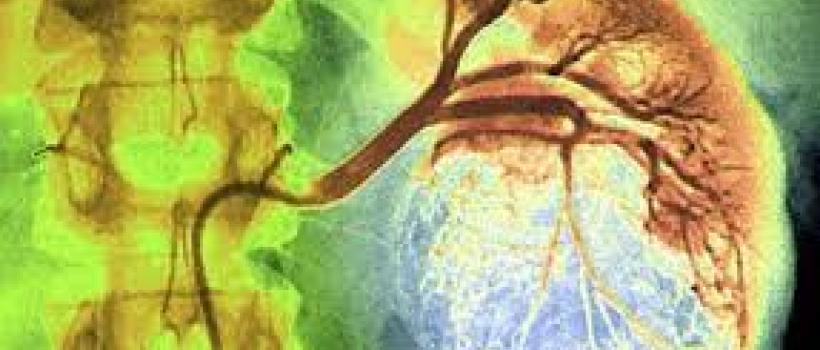 Global Kidney Cancer