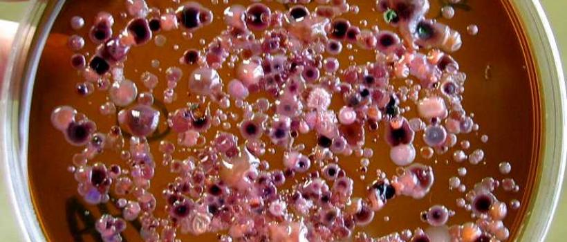 Microbiology Culture