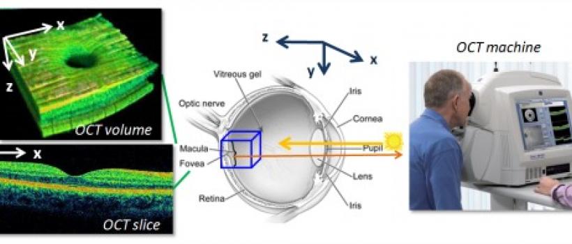 OCT Imaging System