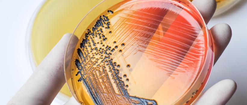 salmonella testing market