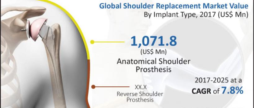 Shoulder Replacement Market