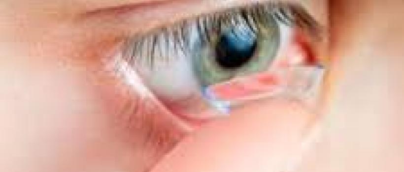 Global Smart Contact Lenses Market