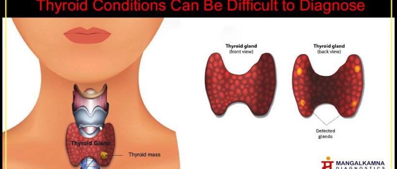 Thyroid Function Test