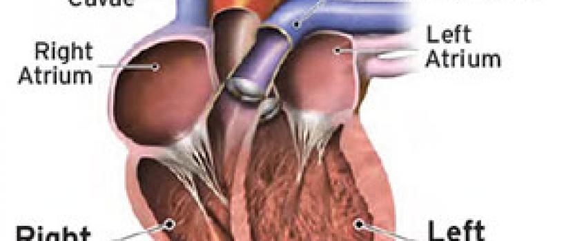  Total Artificial Heart
