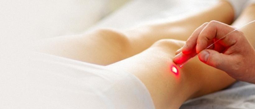  varicose veins treatment market