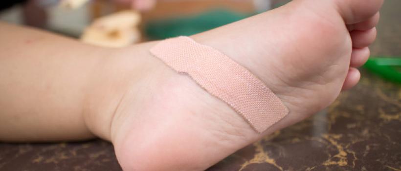 Wound Closure Strips