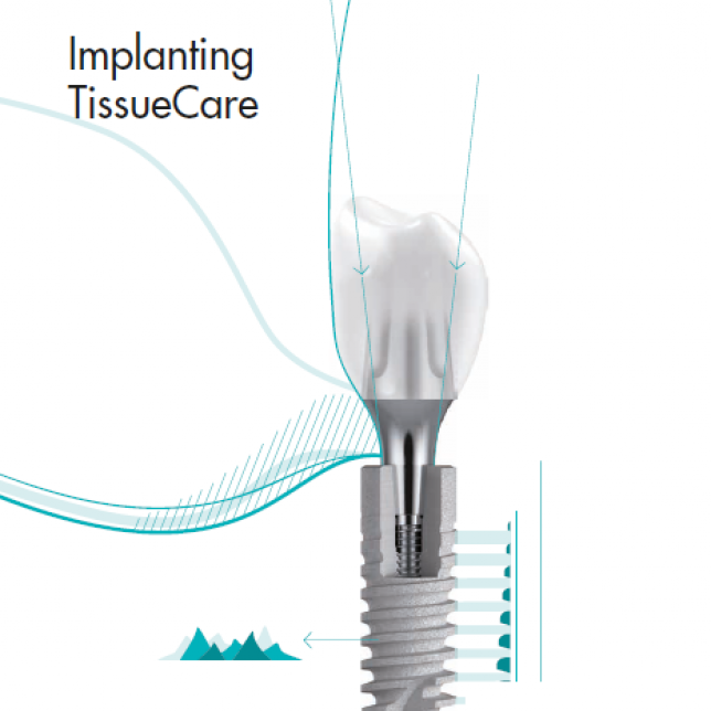 Dentsply Implants / ANKYLOS® FeedsFloor