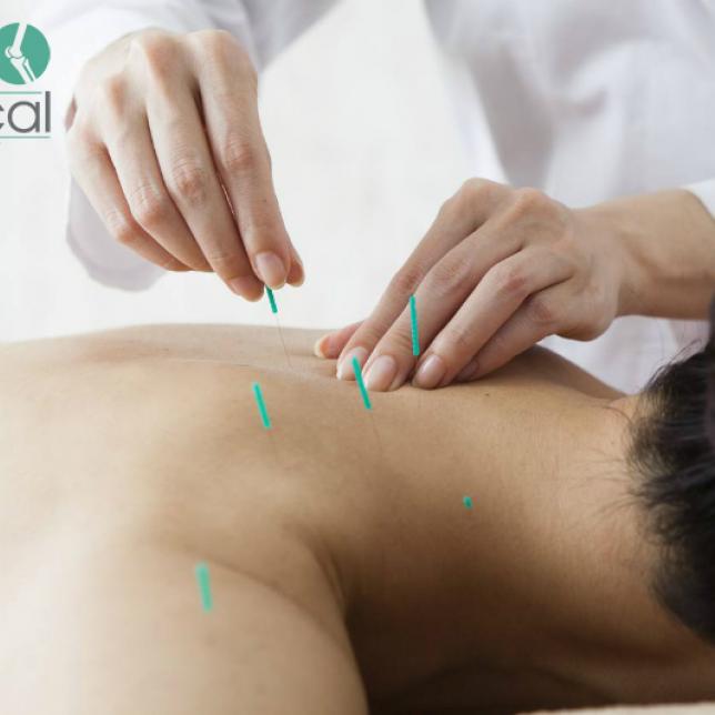 Acupuncture At Home In London From Medical Home Visit