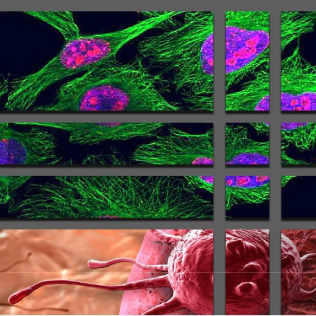 Metastatic Cancer Treatment Market