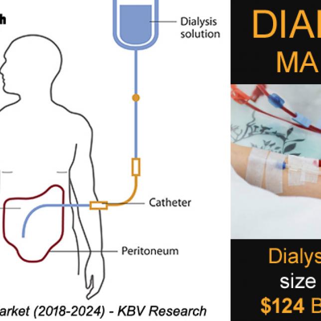 Global Dialysis Market- KBV Research