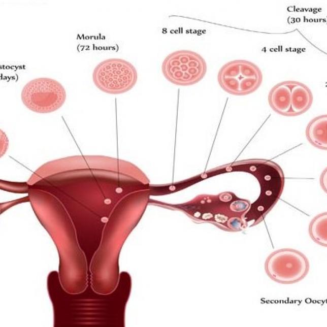 IVF Treatment Hyderabad
