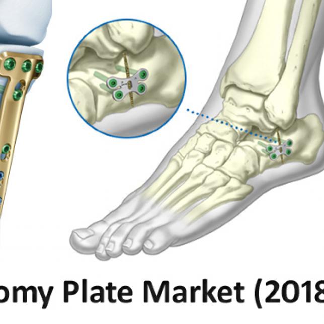 Osteotomy Plate Market- KBV Research